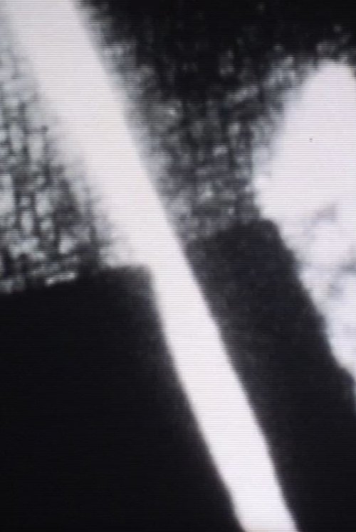 Slow Death 2000