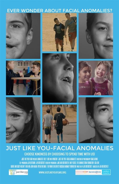 Just Like You: Facial Anomalies 2017