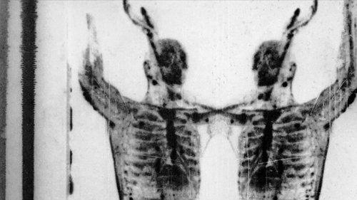 The Radio Wave of Blood Beneath the Dirt Ice and Flowers