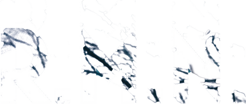 R.M.N.
