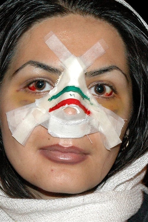 Nose Iranian Style (2006)