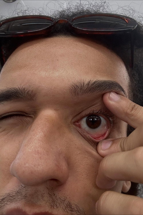 Conceição PH