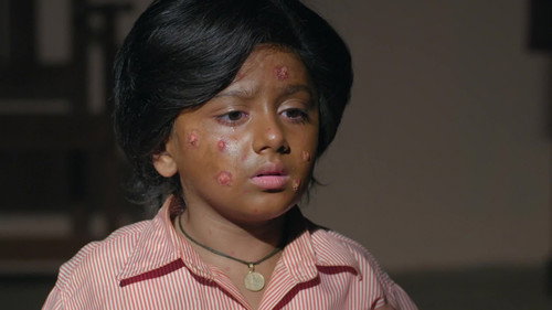 Doree Catches an Infection