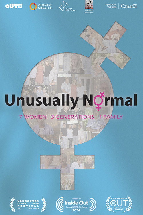 Unusually Normal