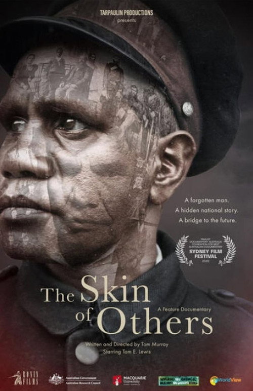 The Skin of Others