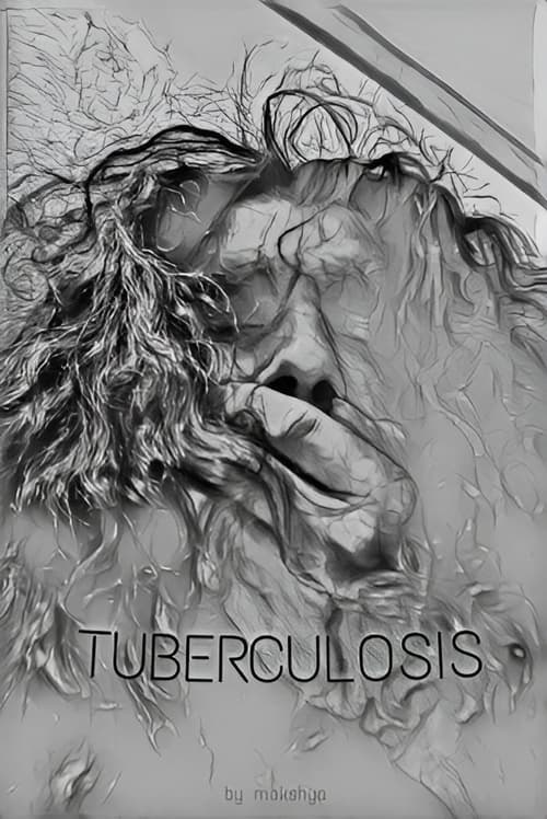 TUBERCULOSIS