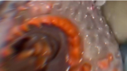 Our Memories Together Won't Rot in the Bag