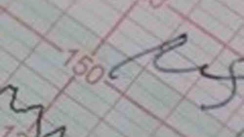 Épisode 24