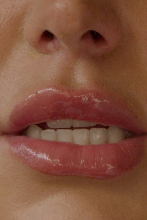 Plumped