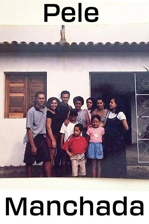 Affiche de Pele Manchada