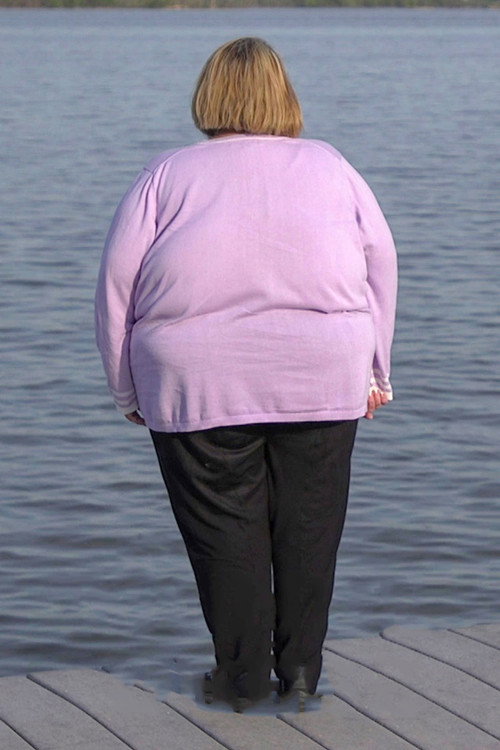 An Obese World poster