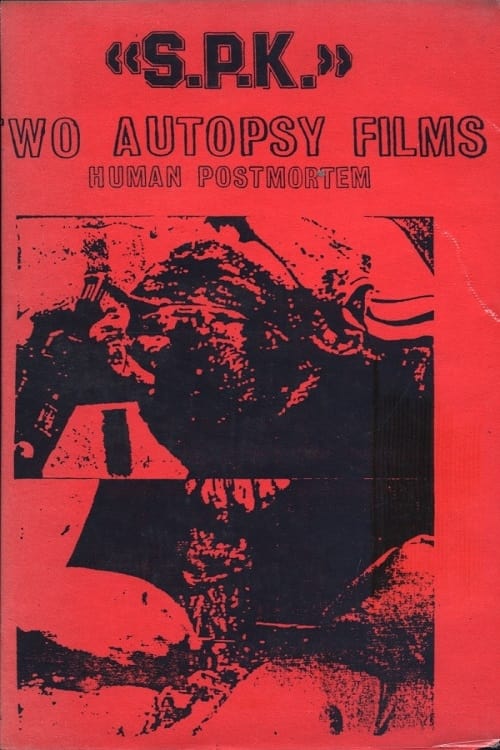 Poster S.P.K.: Two Autopsy Films: Human Postmortem 1983