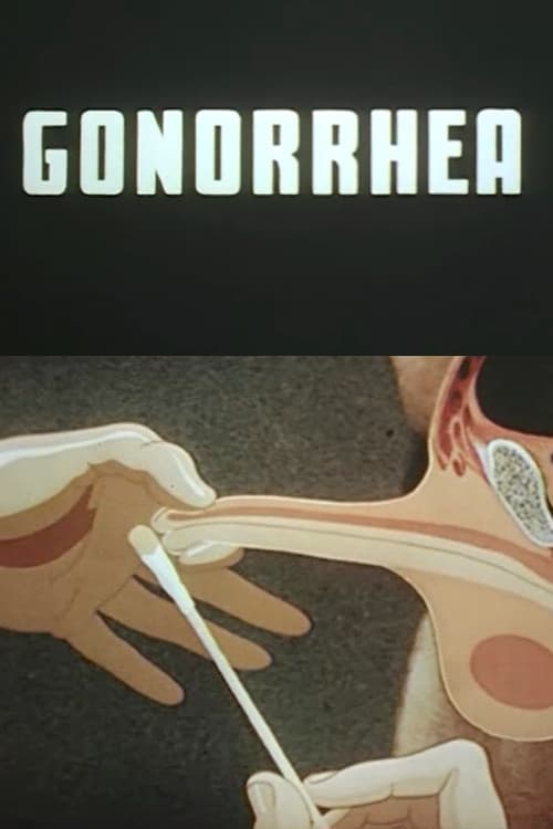 Poster Gonorrhea 1943