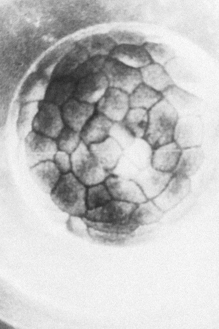 Gestation of the Ovum poster