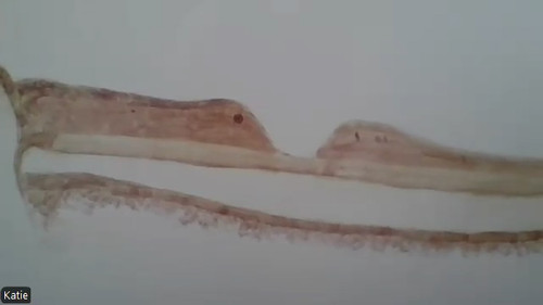 My Schizoaffective Documentary