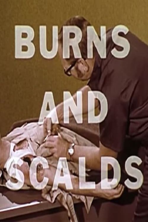 Poster Burns And Scalds 1970