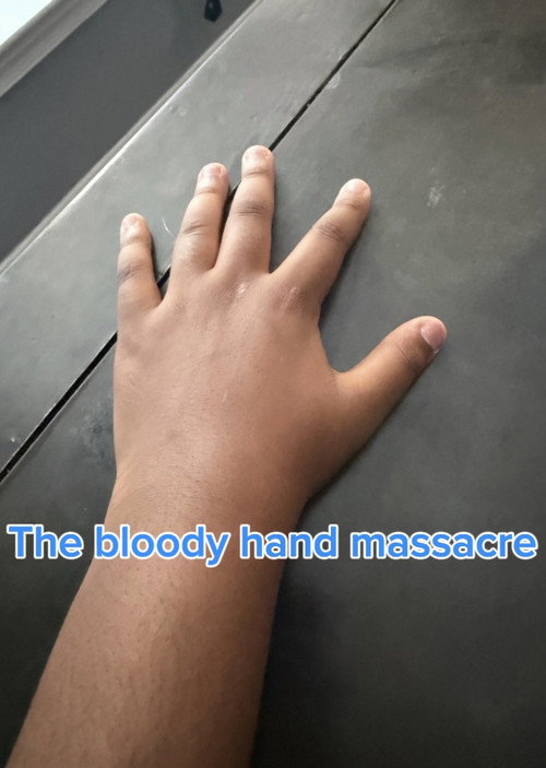 The bloody hand massacre