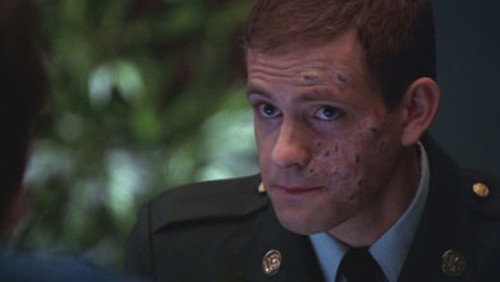 Estética: 3×11