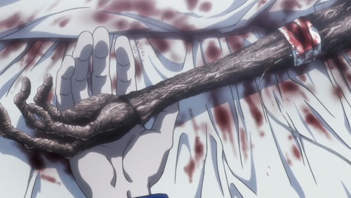 Hunter x Hunter (2011) – Episódio 145