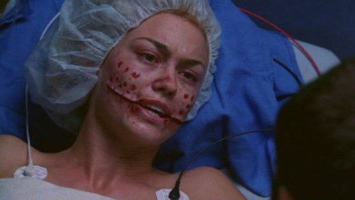 Estética: 3×14