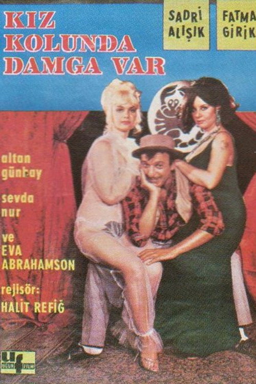 Kiz kolunda damga var