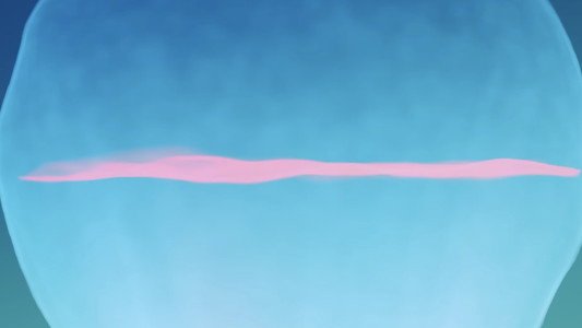 Void