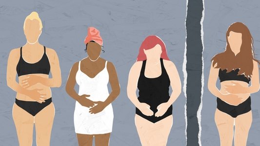 MUM Misunderstandings of Miscarriage