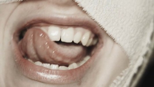 The Bite