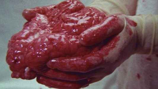 Brain of Blood