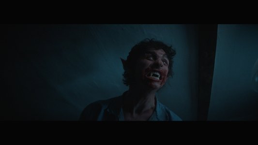 Needleteeth