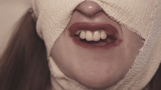 The Bite