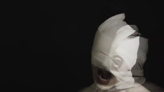 The Bite