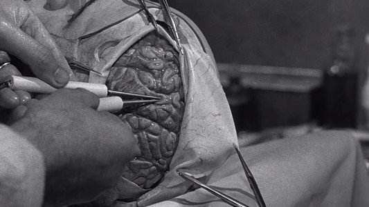 The Brain That Wouldn't Die