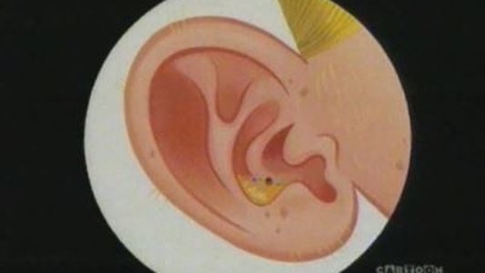 Thumbnail image for Head Band
