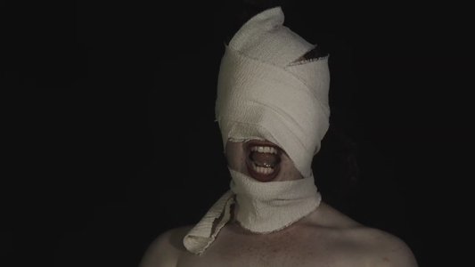 The Bite