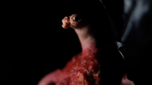 Meat Lump