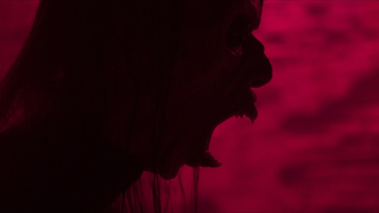 Parasomnia