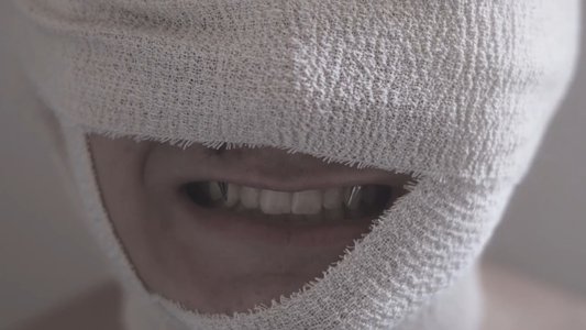 The Bite
