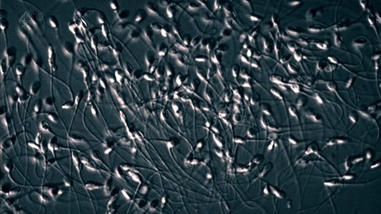 The Great Sperm Race