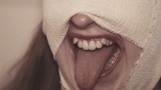 The Bite