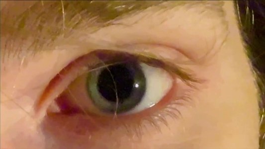 Deep-Eyed