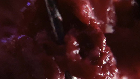 R52.9 Pain, unspecified