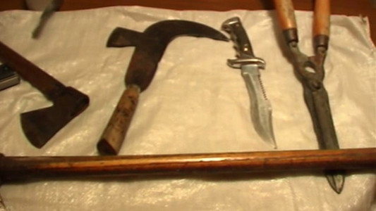Lumbalgia