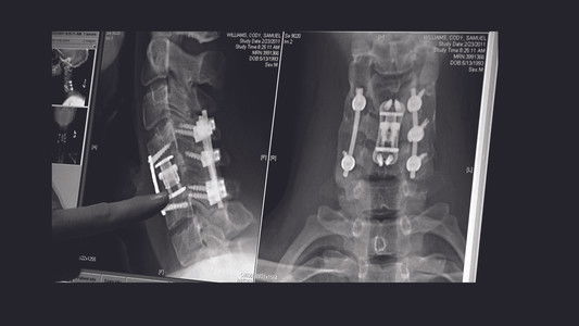 The Hill Chris Climbed: The Gridiron Heroes Story