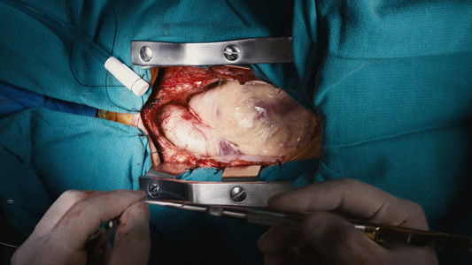 The Killing of a Sacred Deer