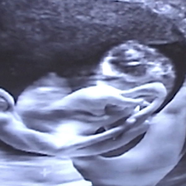 Castration Movie Anthology iii. Year of the Hyaena