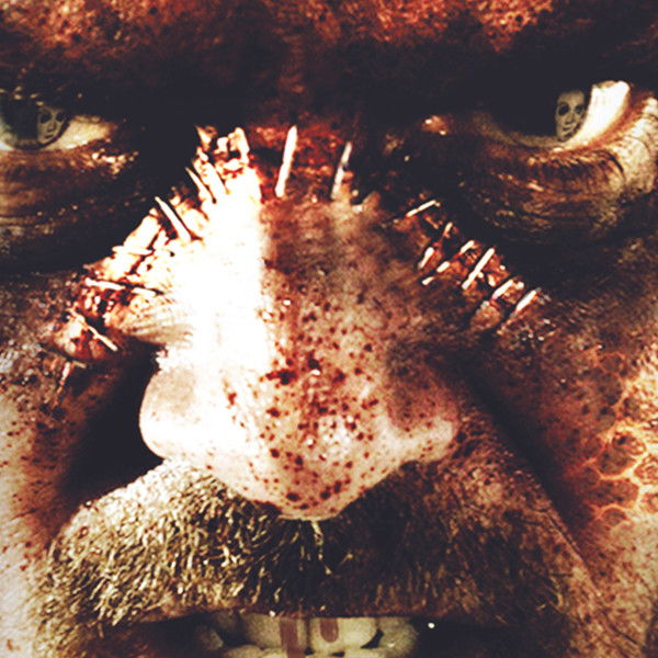 The Frankenstein Syndrome