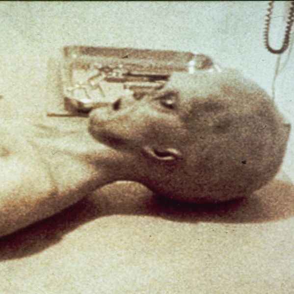 The Alien Autopsy