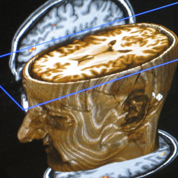 Journey Into Dyslexia