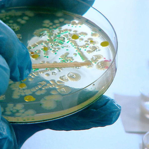 Killer-Keime - Gefahr aus dem Tierstall